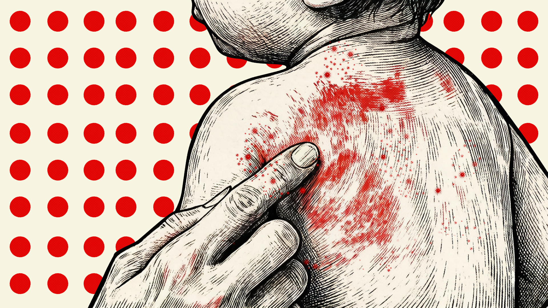 Probe those responsible for measles deaths