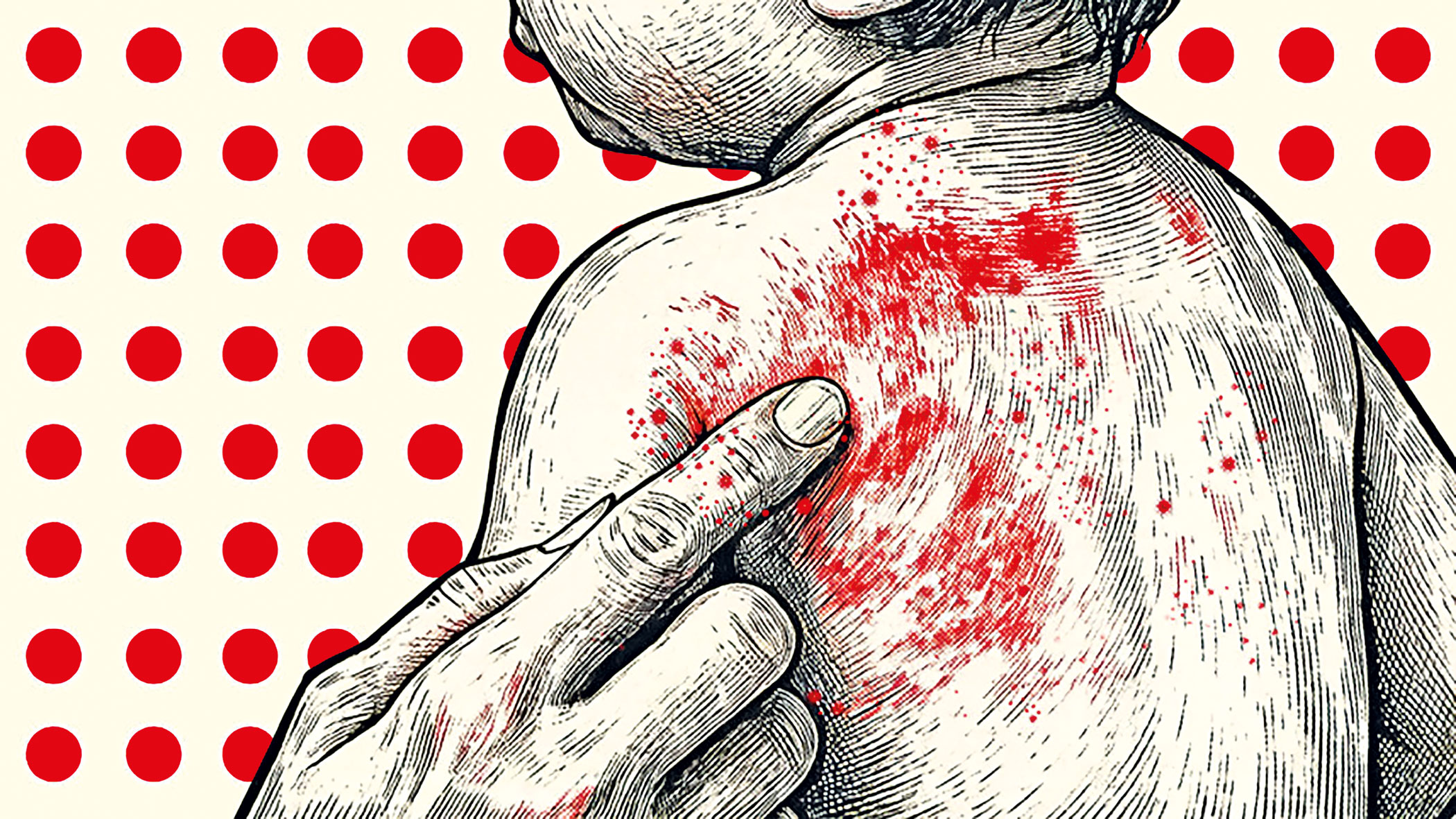 Bangladesh’s measles crisis and the question of legal responsibility