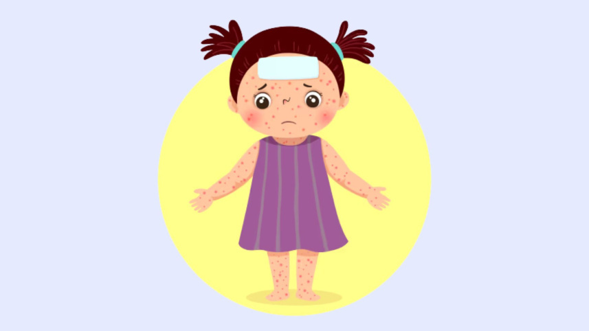 Measles_1.jpg