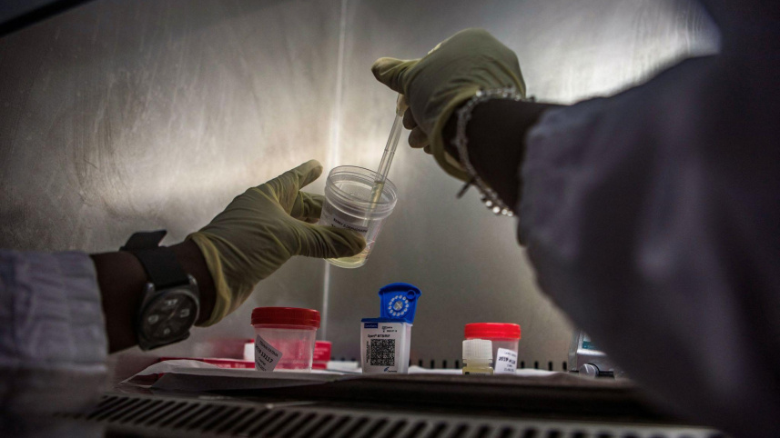 TB-screening-HIV-people.jpg