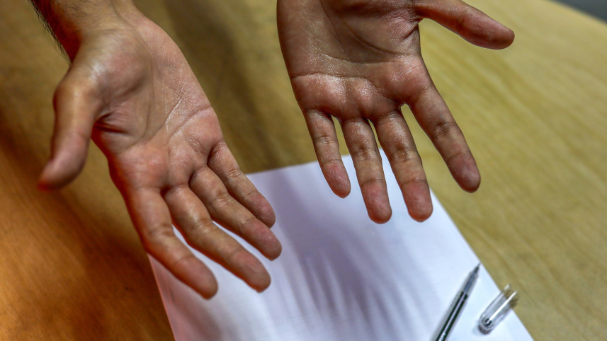 students with hyperhidrosis.jpg