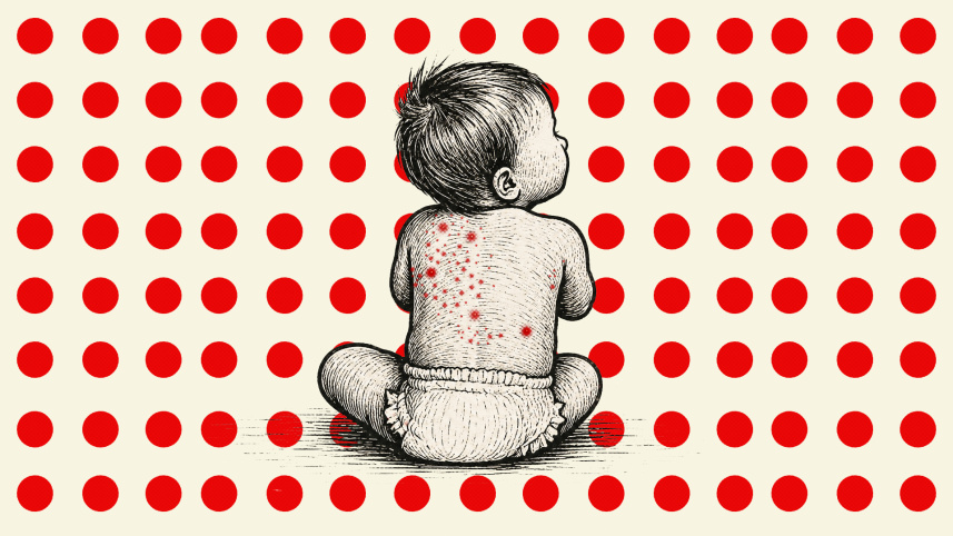 measles deaths in Bangladesh today