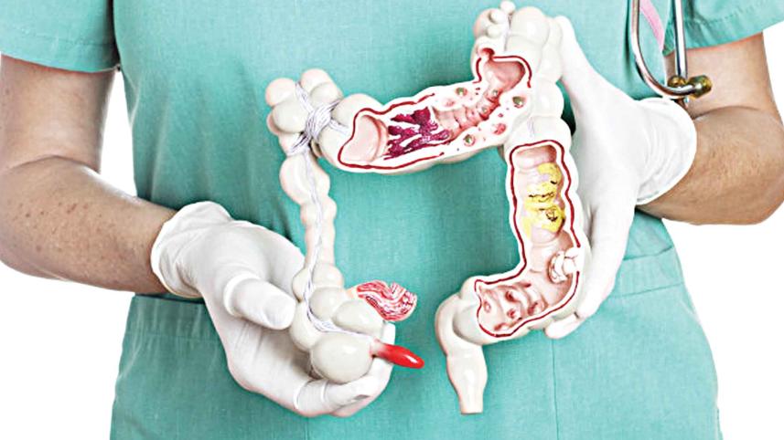stomach.jpg