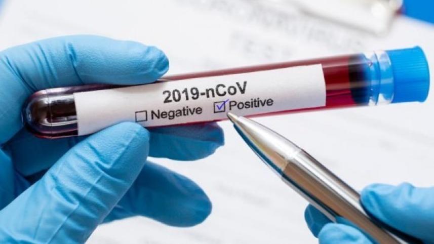 test_coronavirus-positive_0_0.jpg