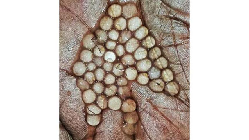 fish-egg-Final.jpg