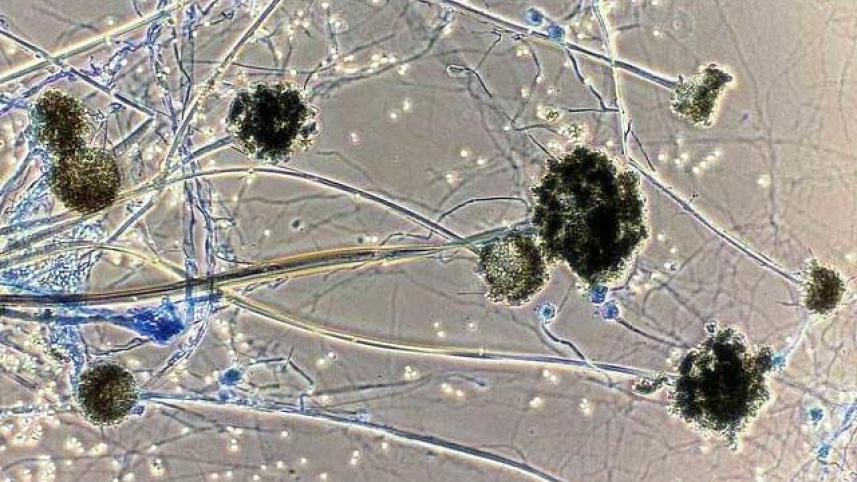 black_fungus_0.jpg