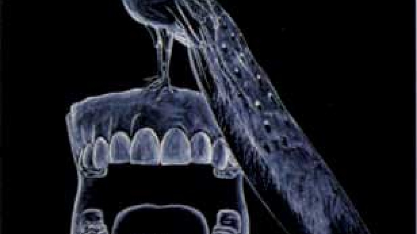 Anonymous Teeth 2