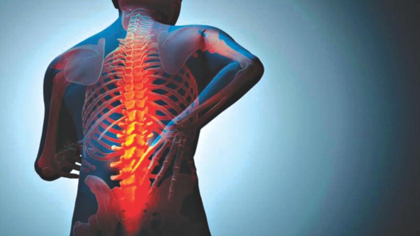 back pain.jpg