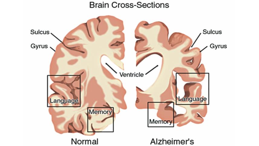 brain.jpg