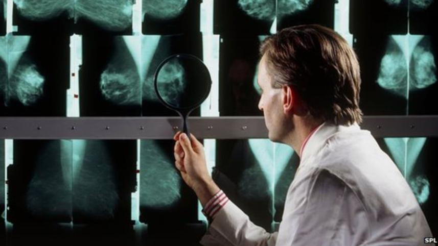 Breast-Cancer--1WB.jpg