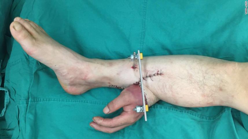 hand-WEB.jpg