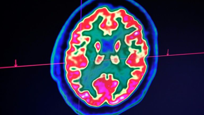 human-brain.jpg