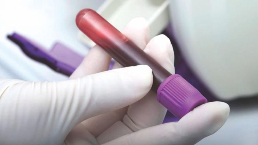 New blood test.jpg