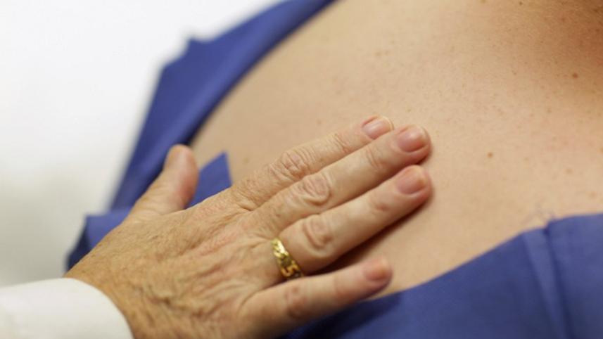 skin-cancer-afp-wb.jpg