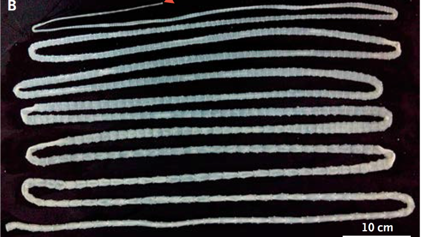 Taenia-saginata-tapeworm.png