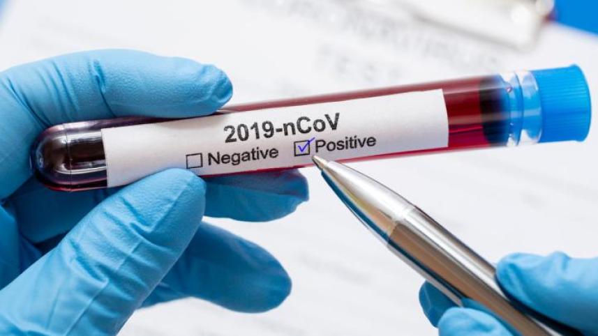 Coronavirus Testing Procedure 