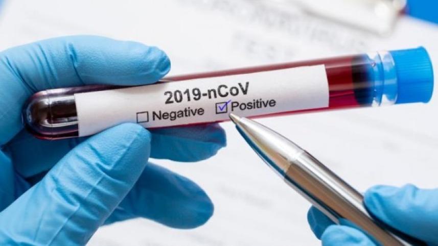 test_coronavirus-positive_0.jpg