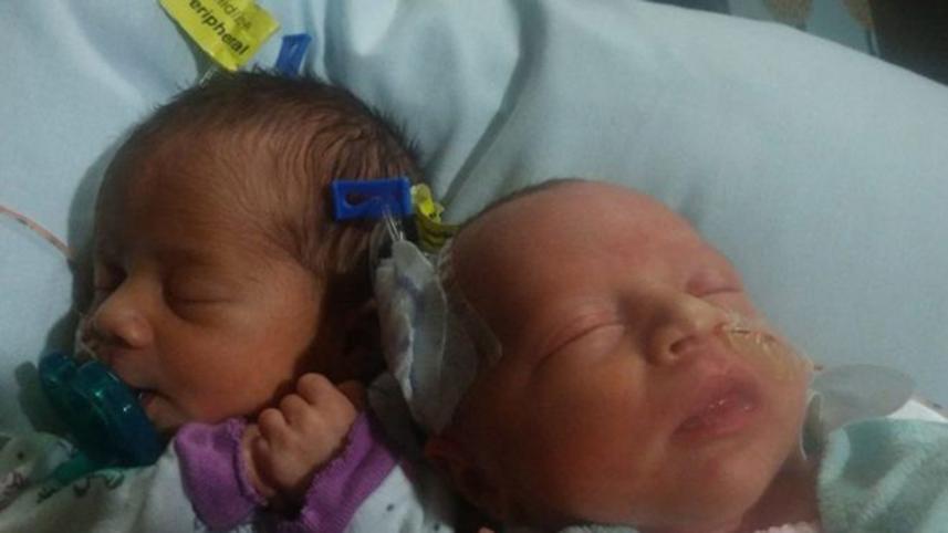 twins-birth.jpg