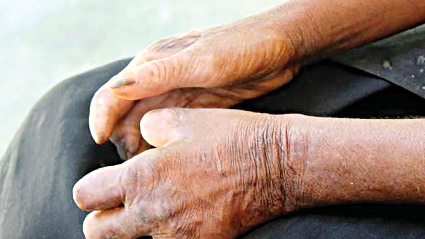 leprosy.jpg