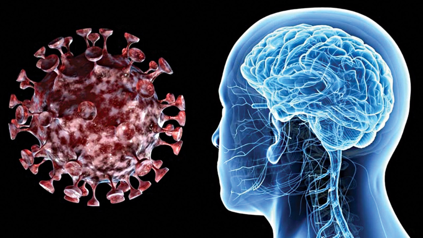 magnetic-resonance-imaging.jpg