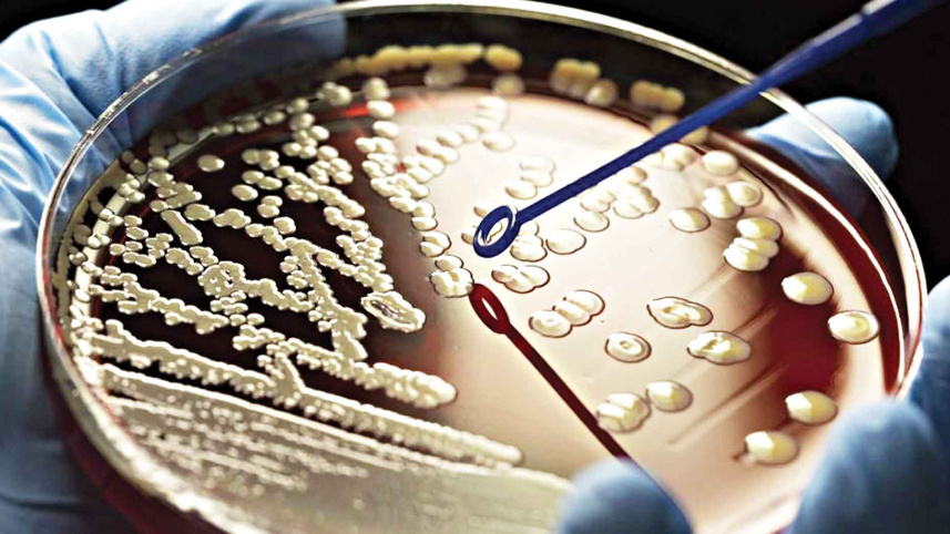 typhoid-causing-bacteria.jpg