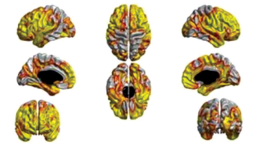 Brain