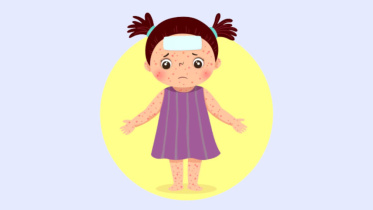 Measles.jpg