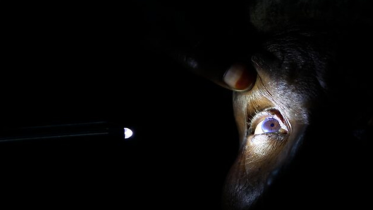 Cataract surgery.png