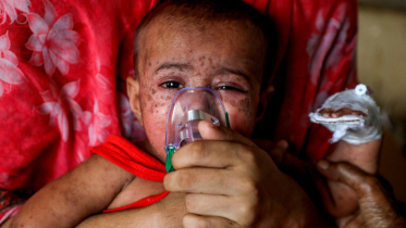 measles outbreak in Bangladesh.jpg