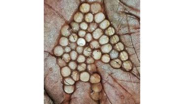 fish-egg-Final.jpg