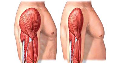 sarcopenia.jpg