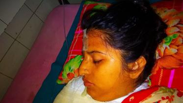 acid-victim-smollah.jpg
