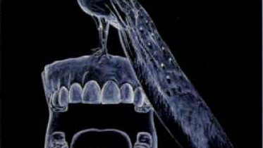 Anonymous Teeth 2