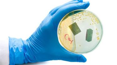 Bacteria-UTI-SequencingWB.jpg