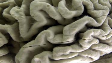 brain.jpg