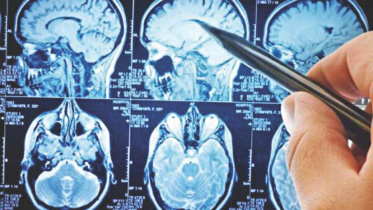 ct scan.jpg