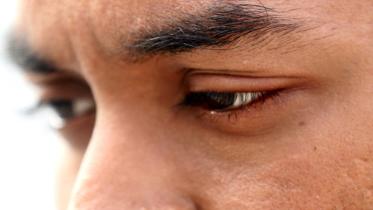 eye