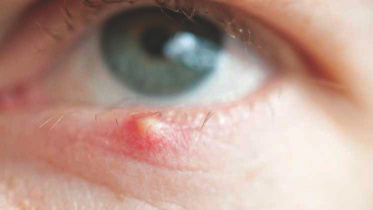 eye.jpg