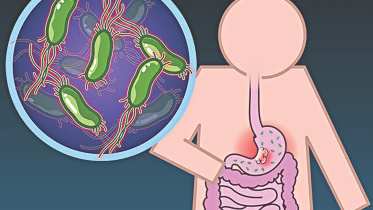 gastric cancer.jpg