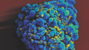 hiv virus.jpg