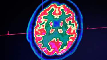human-brain.jpg