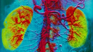 Kidney--1WB.jpg