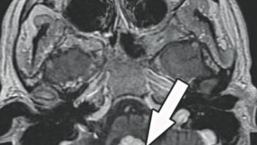 mri.jpg