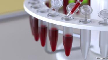 ovarian-cancer-NWB.jpg