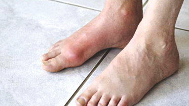 pain toe.jpg
