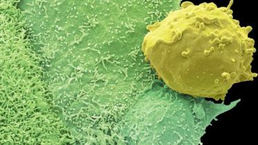 Prostate-cancer-web.jpg
