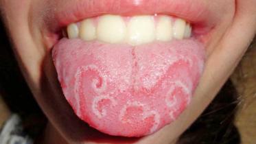 Tounge