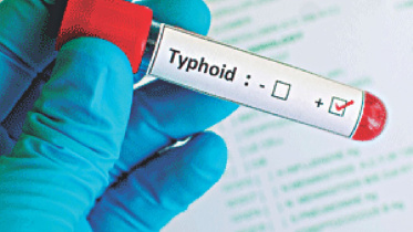 Typhoid Vaccine 