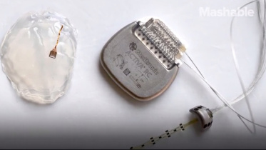Brain implants 