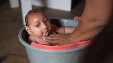zika virus.jpg